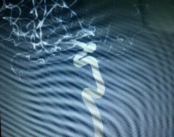 RICA precoiled